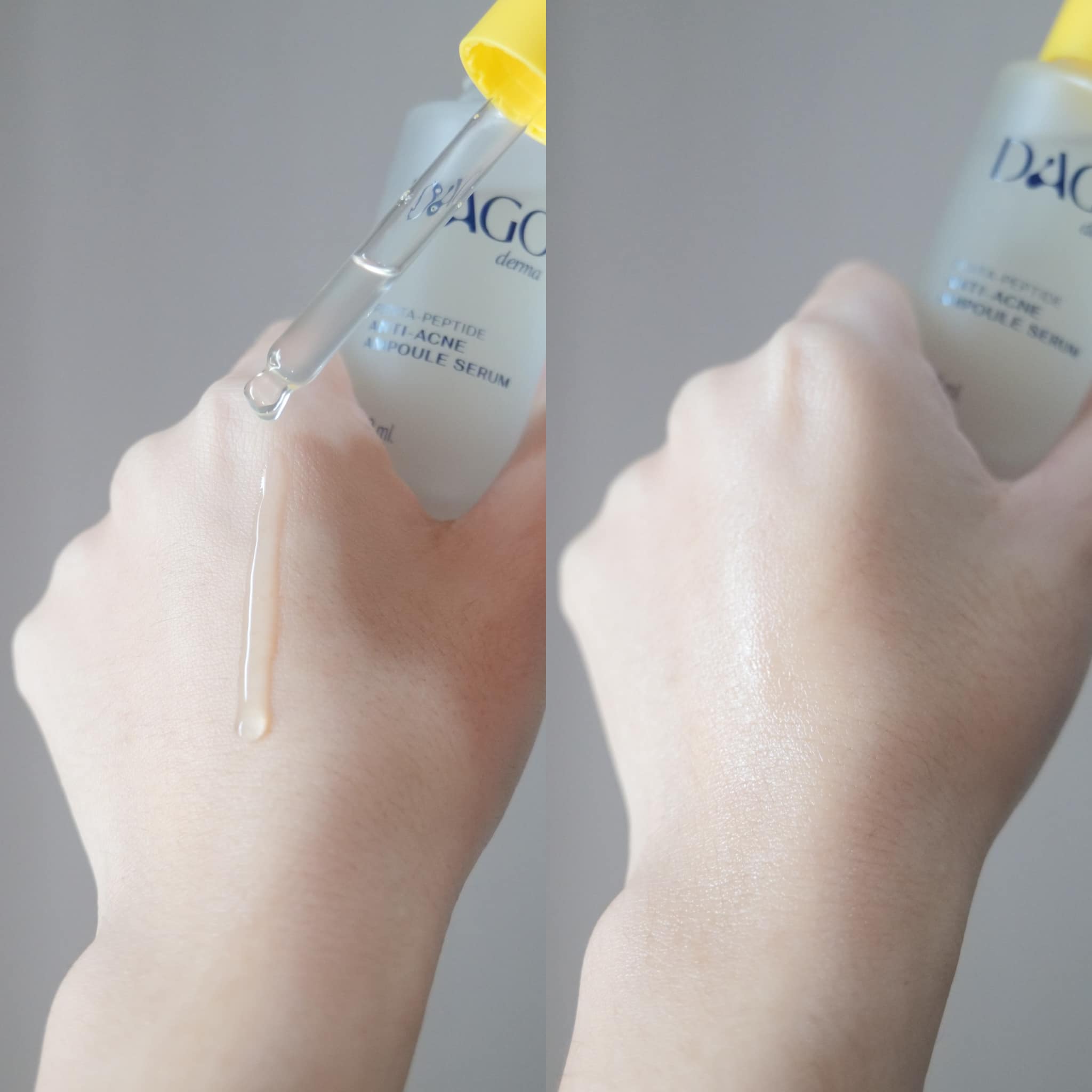 Dagoderma Penta Peptide Anti-Acne Ampoule Serum